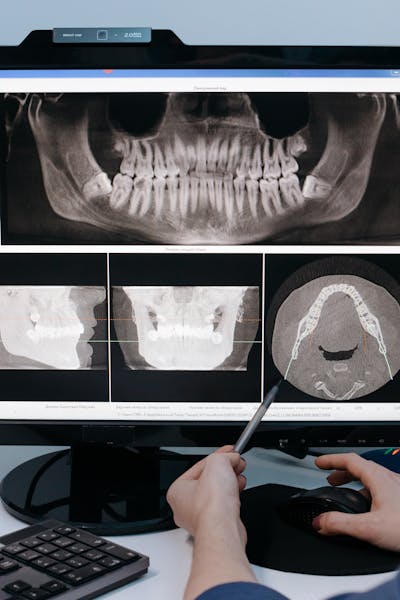 Dental implant model showing permanent tooth replacement